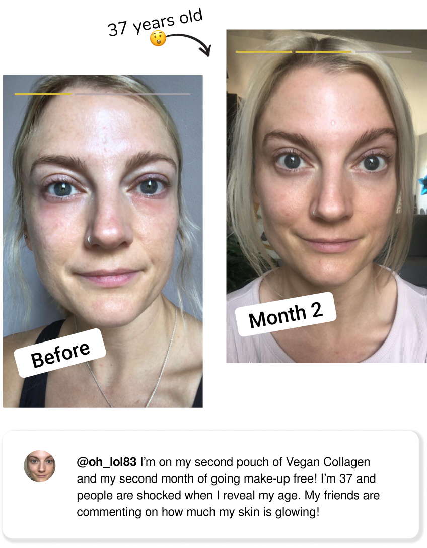 The secret to actually get rid of wrinkles no matter what your age